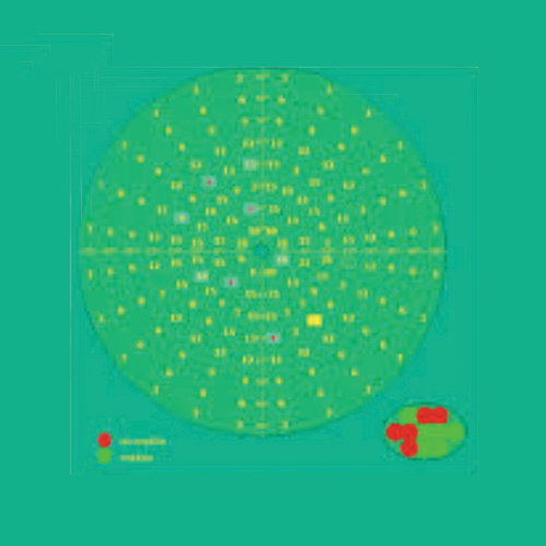 Perimetria computerizzata (esame del campo visivo)