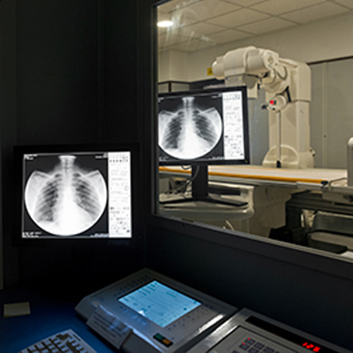 RX Torace Montallegro