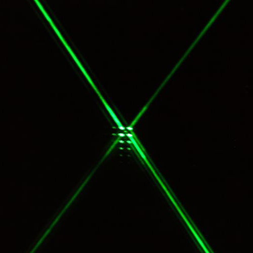 Resezione prostatica con laser verde (green light laser)