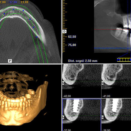 Dentalscan